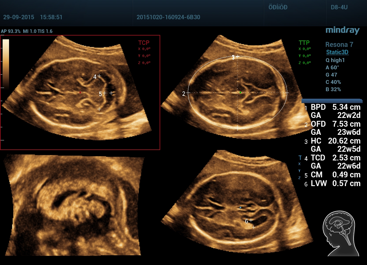 Акушерство Smart Plane 4D