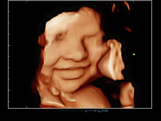 Лицо эмбриона