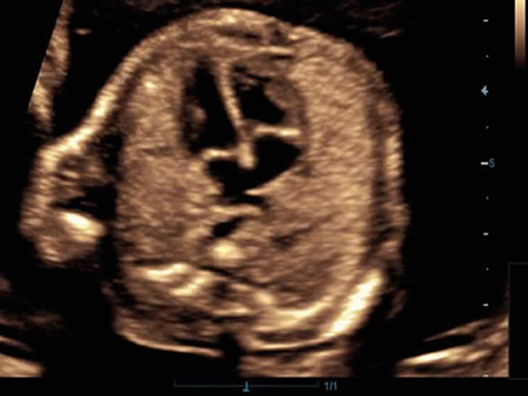 Сердце эмбриона