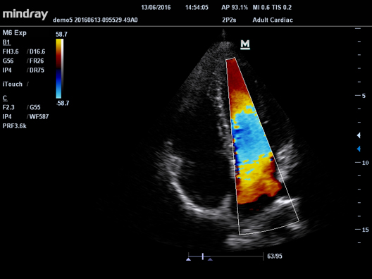 Кардиологические исследования CFM