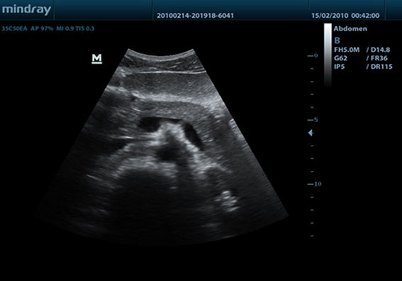 Клинические изображения Mindray DP-50 Color