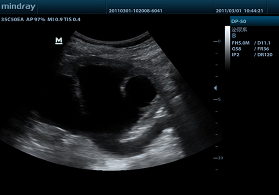 Клинические изображения Mindray DP-50 Color