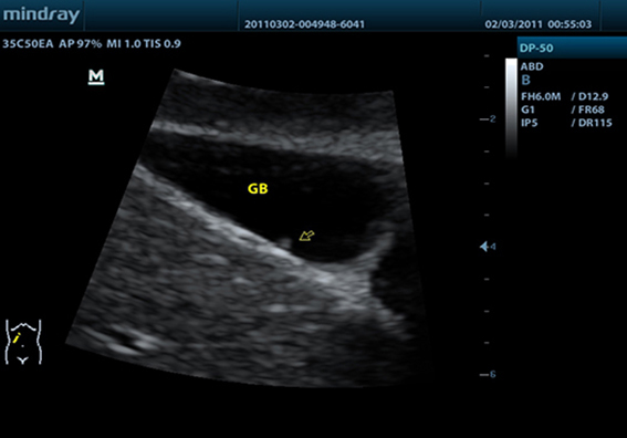Клинические изображения Mindray DP-50 Color