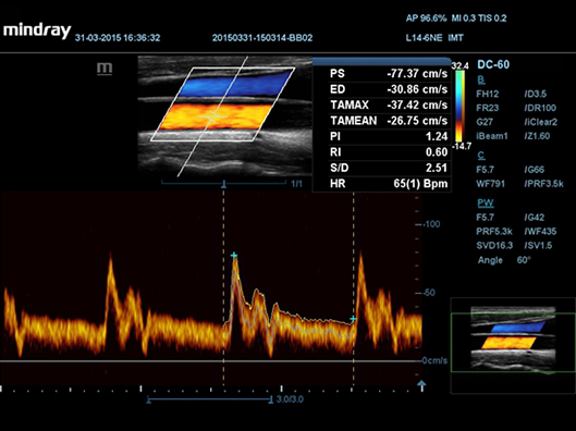 ОСА, автоматическая трассировка и измерения