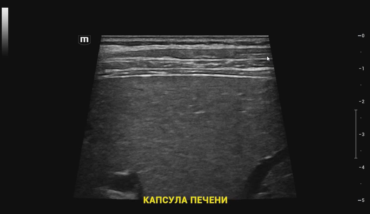 Капсула печени