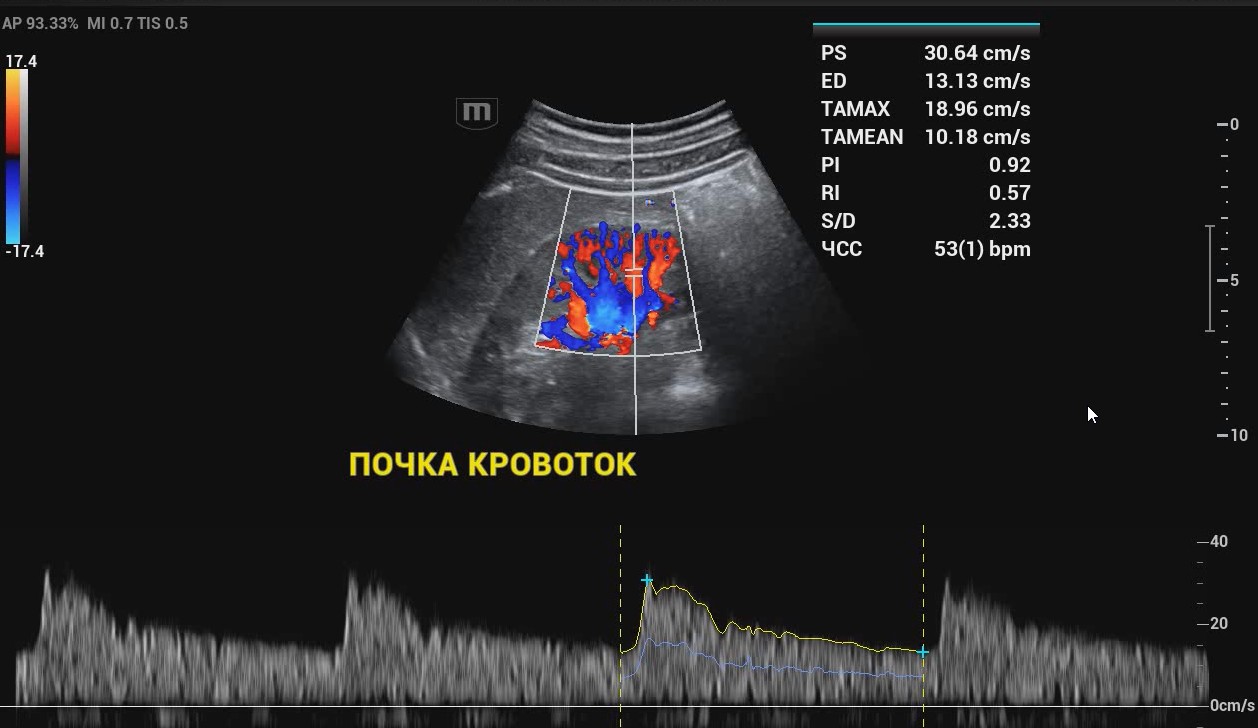 Почка кровоток