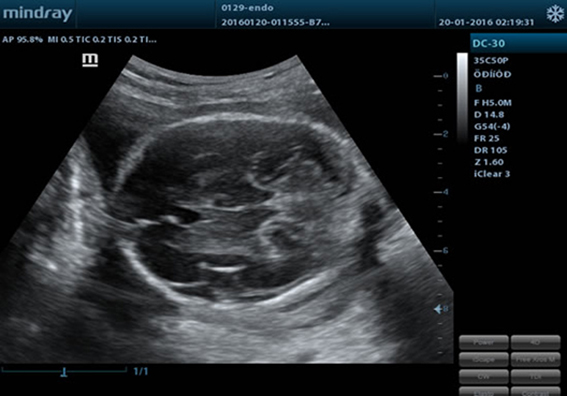 Голова эмбриона